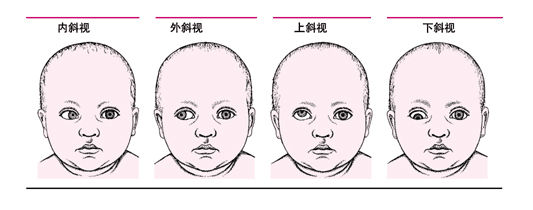 國內(nèi)知名兒童眼病專家岳以英教授空降蘭州