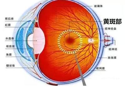 老年人眼底出血要根據(jù)綜合身體情況來(lái)診療